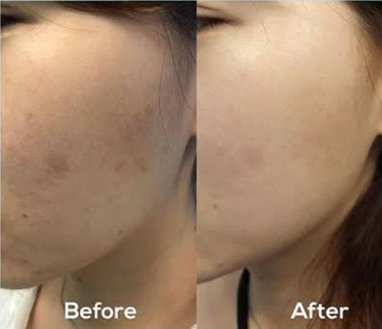 Axis-Y סרום זוהר לתיקון כתמים כהים, 50 מ"ל (1.69 אונקיות נוזל