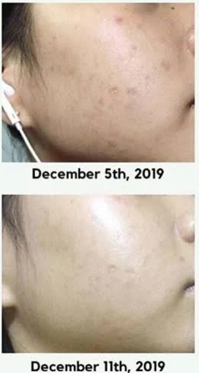 Axis-Y סרום זוהר לתיקון כתמים כהים, 50 מ"ל (1.69 אונקיות נוזל